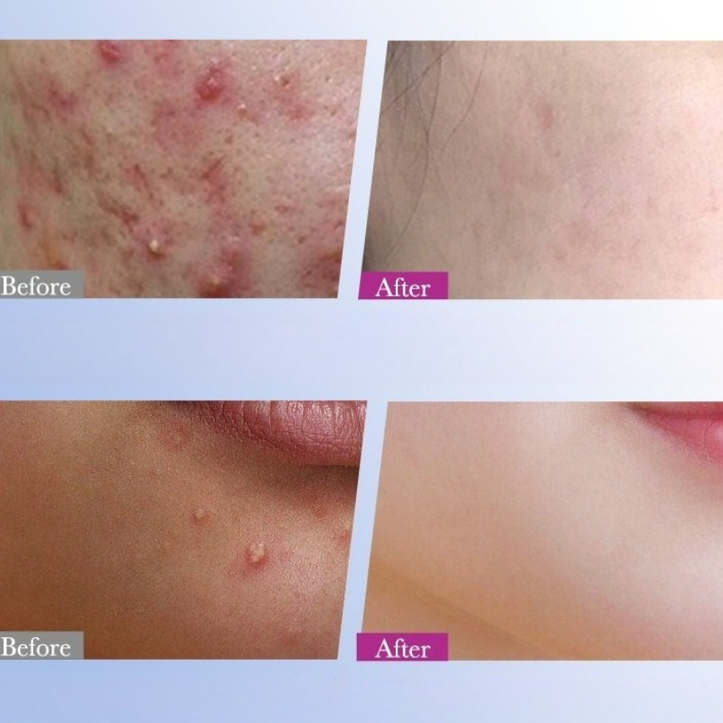 7/10/14 pçs colorido estrela a - Skincare Qv avaliação e preço