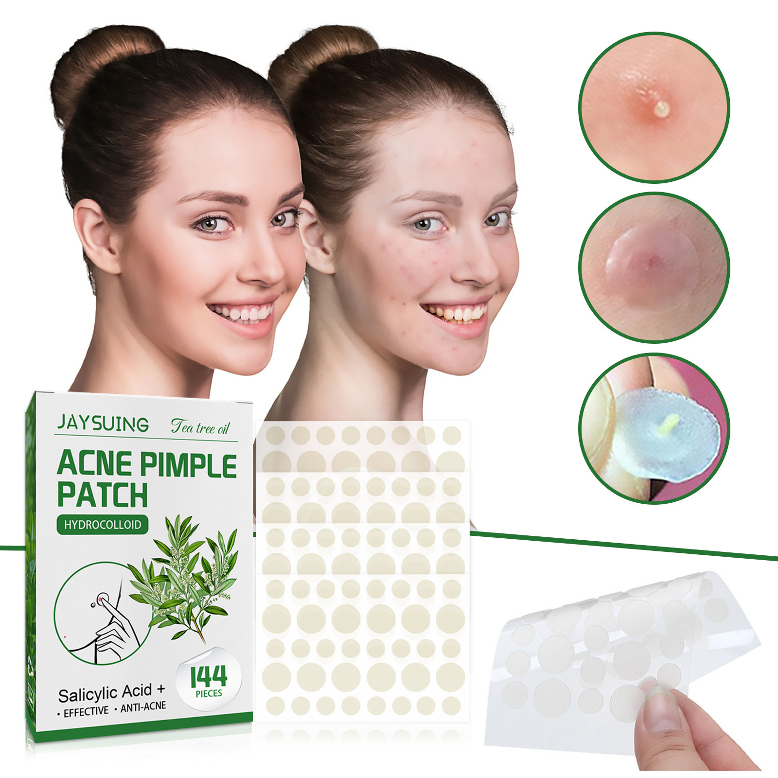 Patches hidrocolóides para acn - Skincare The Originote avaliação e preço