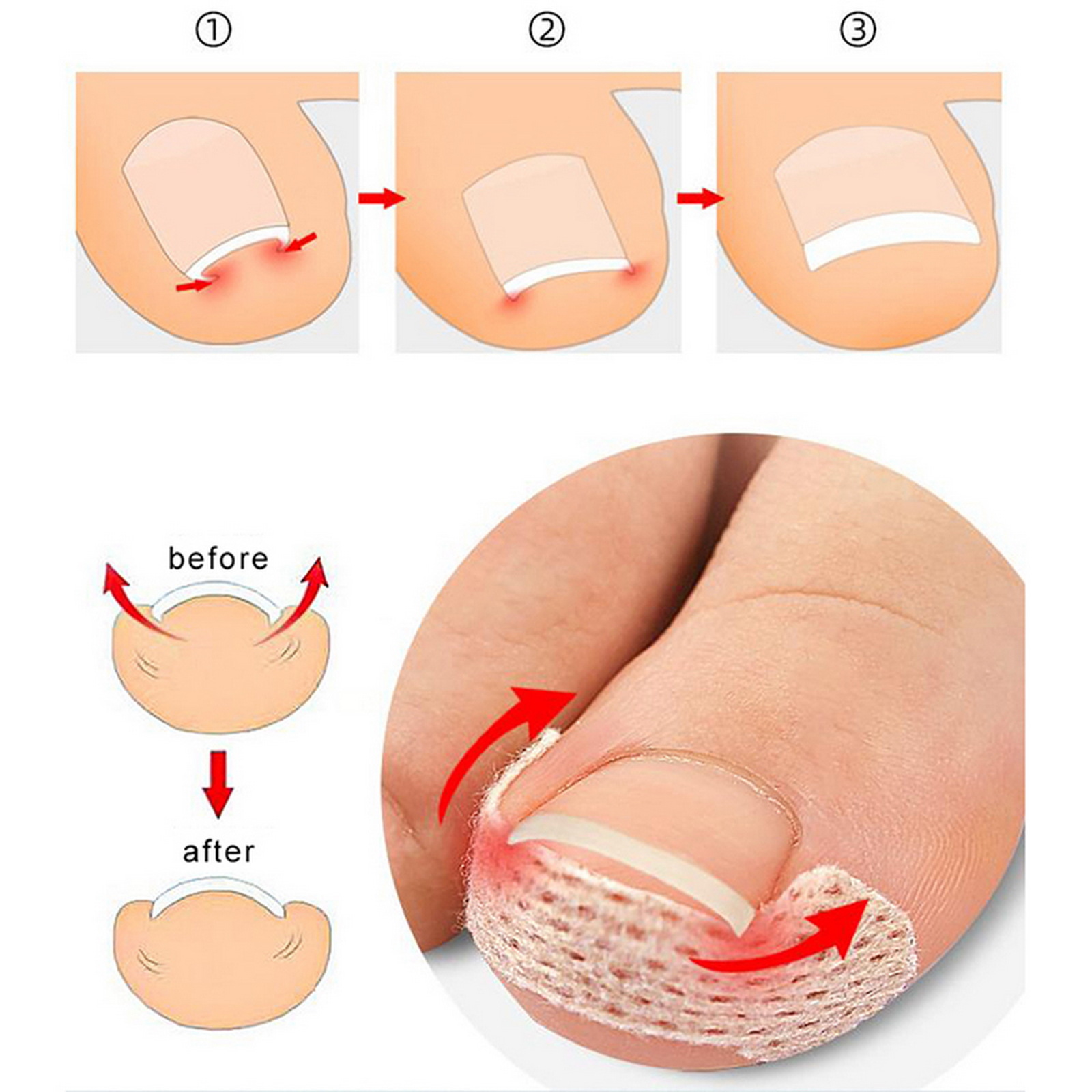 10-100 Peças Adesivo para Unha - Skincare Oily Skin avaliação e preço